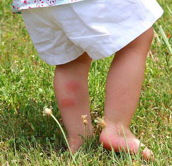 Attention aux aoûtats dans l'herbe