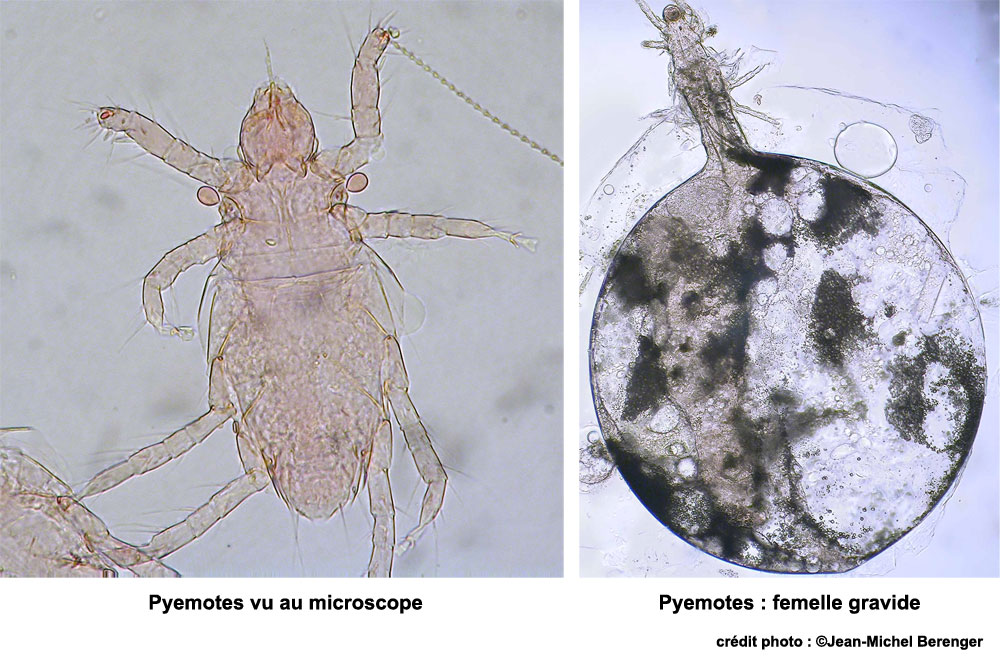 Pyemotes vu au microscope